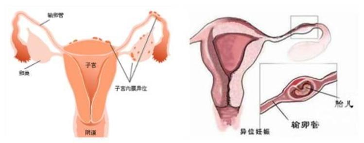 试纸