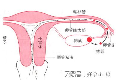 语言发育迟缓