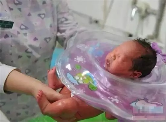 试管婴儿