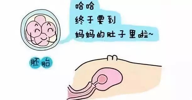 宫内早孕