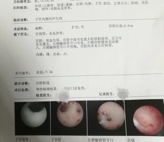 足月妊娠