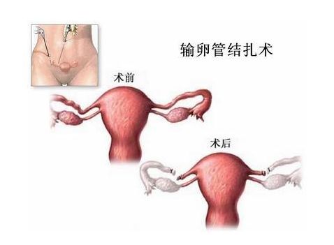 试管试纸