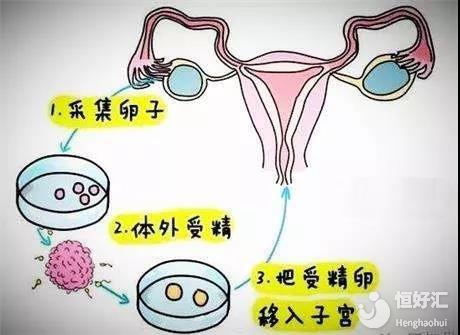 语言发育迟缓