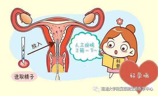 试管婴儿