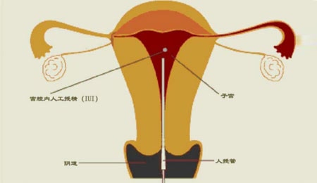 怀孕起始时间