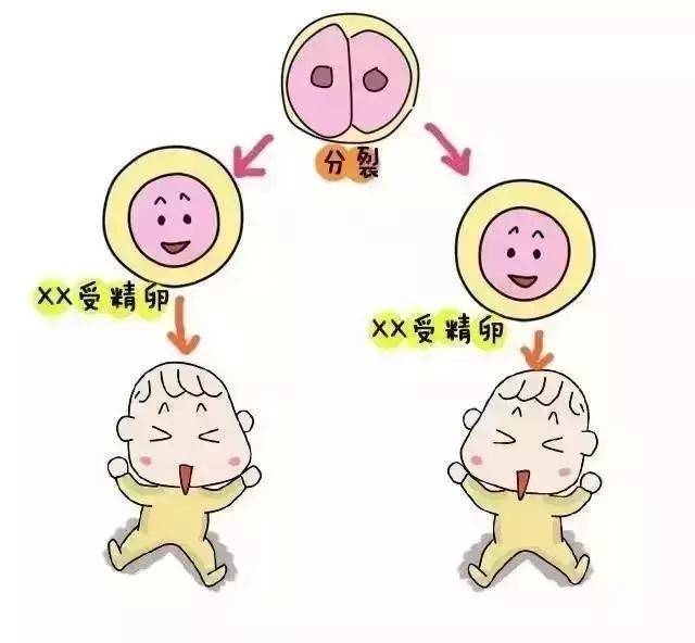 语言发育迟缓