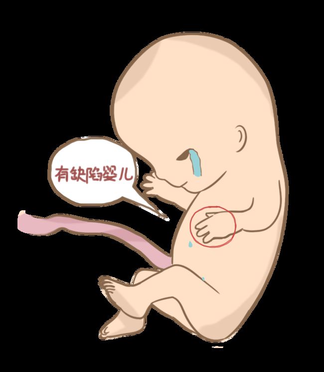起诉离婚