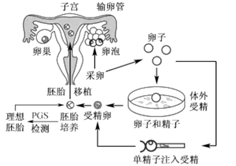 试管婴儿