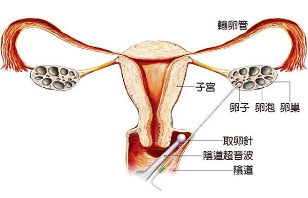 超级育儿师