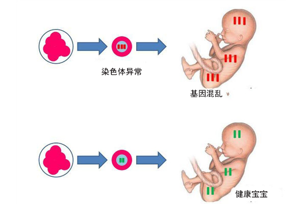 孕前检查