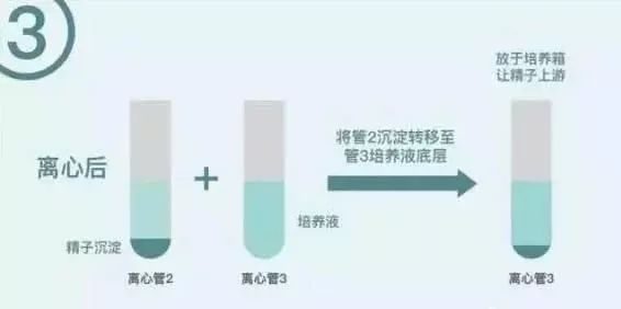 佛山试管婴儿
