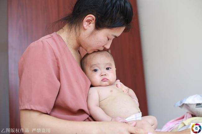 试管婴儿